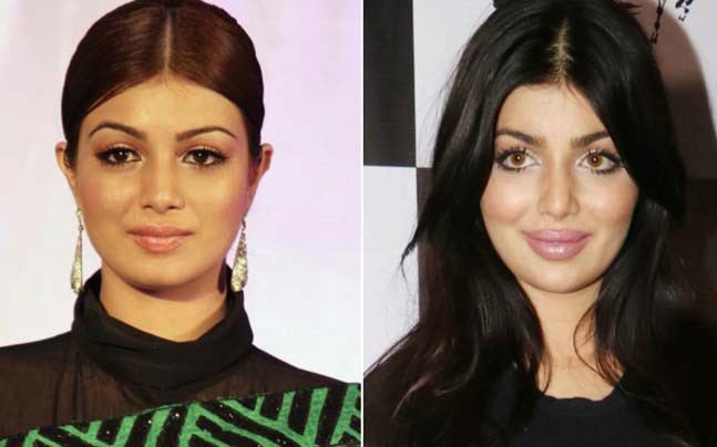 Bollywood Celebs Who Became Unrecognizable After Plastic Surgery