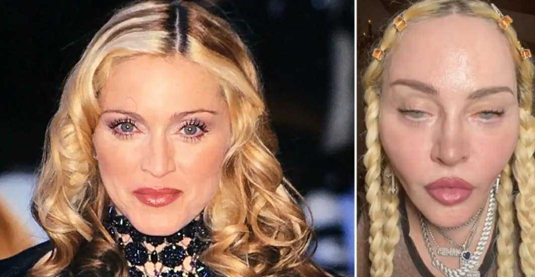 what happened to madonna’s face 2022