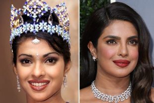 botched surgery priyanka chopra,botched meaning,botched surgery meaning,priyanka chopra met gala,nick jonas,priyanka chopra net worth,priyanka chopra miss world,priyanka chopra young,priyanka chopra age