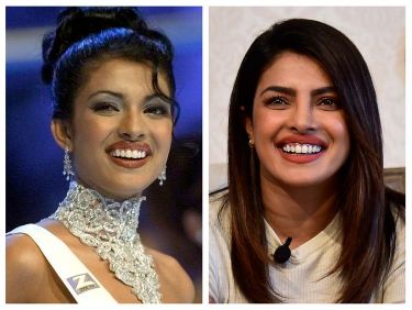 botched surgery priyanka chopra,botched meaning,botched surgery meaning,priyanka chopra met gala,nick jonas,priyanka chopra net worth,priyanka chopra miss world,priyanka chopra young,priyanka chopra age