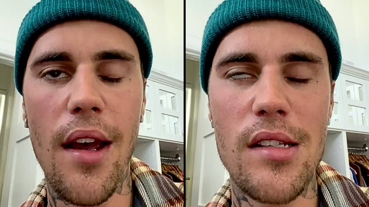 justin bieber ramsay hunt syndrome,ramsay hunt syndrome causes,justin bieber disease lyme,ramsay hunt syndrome vs bells palsy,ramsay hunt syndrome recovery,hailey bieber health,ramsay hunt syndrome rhs,justin bieber news accident,ramsay hunt syndrome vs bell's palsy,justin bieber health update ramsay hunt syndrome *2017*,ramsay hunt syndrome justin bieber video,justin bieber health update