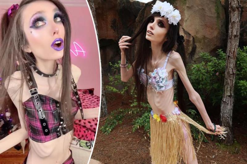 eugenia cooney 2023,eugenia cooney before weight loss,what does eugenia cooney eat,how is eugenia cooney still alive,how is eugenia cooney still alive 2023,eugenia cooney health condition,eugenia cooney daughter,eugenia cooney health,eugenia cooney health update 2023,eugenia cooney health update today,eugenia cooney health update in hindi,eugenia cooney health update 2022